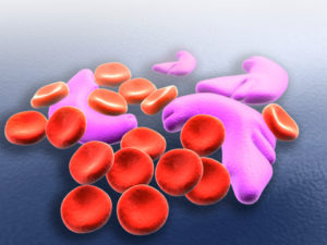Conceptual image of sickle cell anemia.
